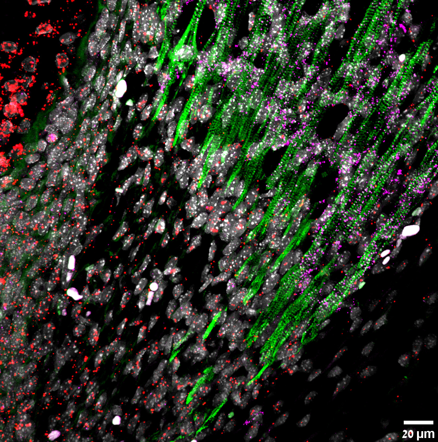 Cells Expressing Tendon Markers Fuse into Muscles